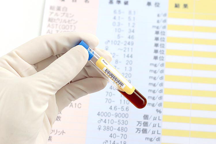 健康診断のイメージ画像